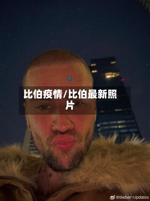 比伯疫情/比伯最新照片-第1张图片