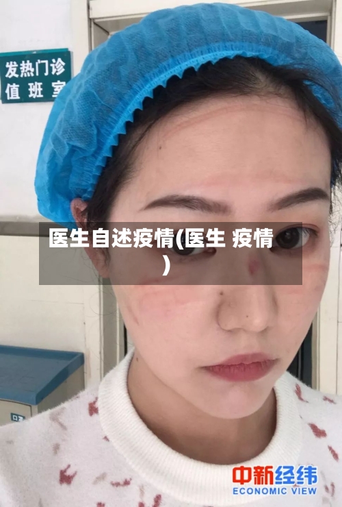 医生自述疫情(医生 疫情)-第1张图片