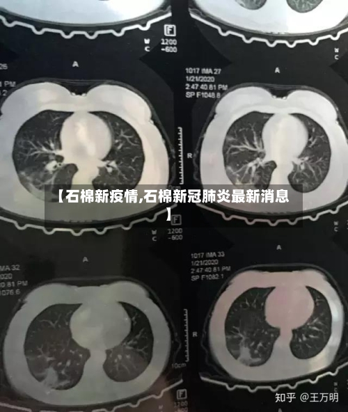 【石棉新疫情,石棉新冠肺炎最新消息】-第1张图片