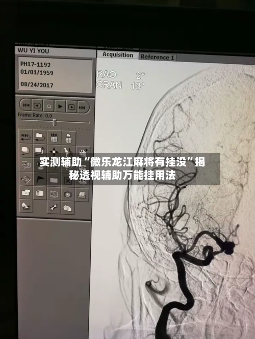 实测辅助“微乐龙江麻将有挂没”揭秘透视辅助万能挂用法-第2张图片