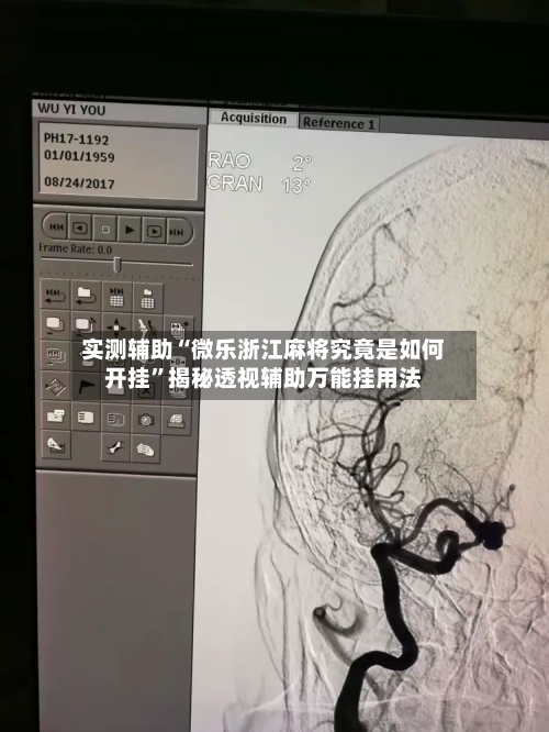 实测辅助“微乐浙江麻将究竟是如何开挂”揭秘透视辅助万能挂用法-第2张图片
