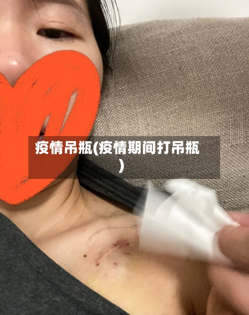 疫情吊瓶(疫情期间打吊瓶)-第2张图片